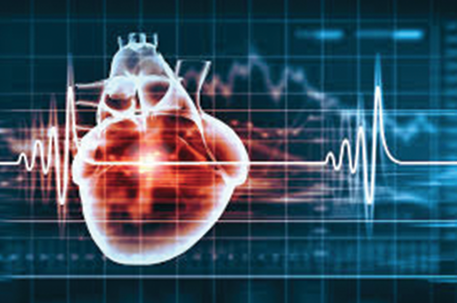 Maladies cardiovasculaires